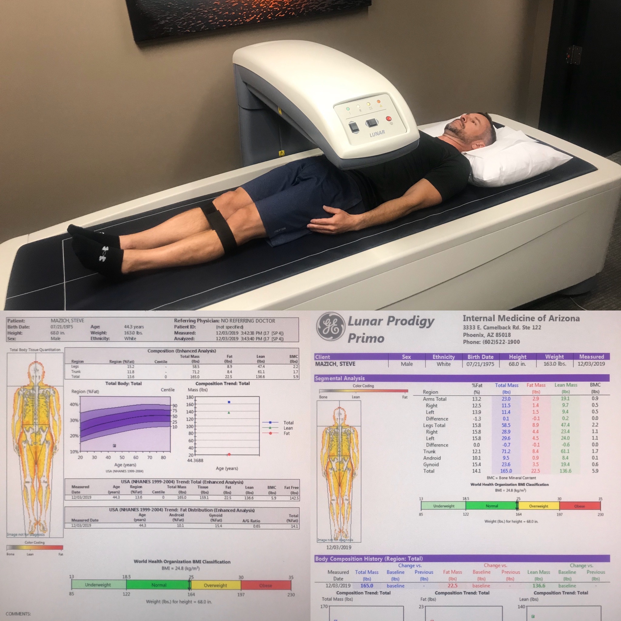 DEXA scan for muscle mass evaluation